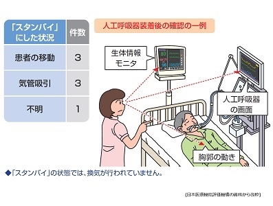 人工呼吸器のスタンバイ状態、解除忘れに注意をのサムネイル画像