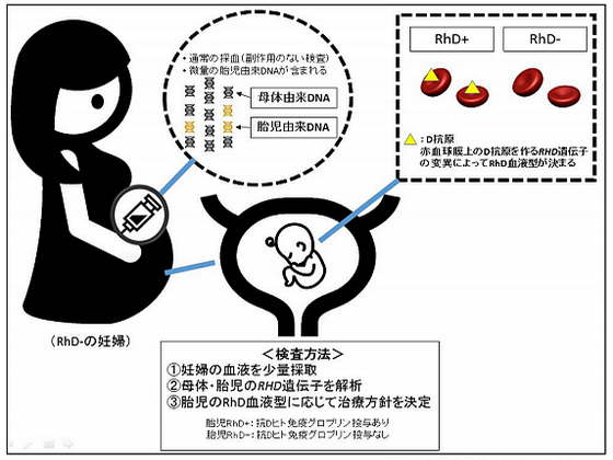 新出生前検査法、妊婦の血液から胎児の血液型を判定のサムネイル画像