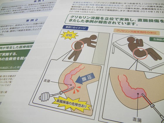 立位でのグリセリン浣腸、直腸損傷に注意のサムネイル画像