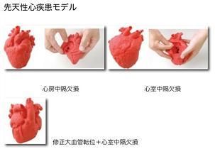 心臓の形状をリアルに再現、国循などが開発