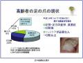 つめのケアは看護師の「療養上の世話」のサムネイル画像