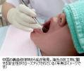 中国〝義歯〟から鉛「安全に問題」のサムネイル画像