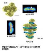 ヒト染色体を丸ごと観察、医学応用へ期待のサムネイル画像