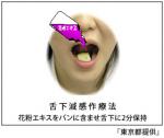 花粉症改善に「舌下減感作療法」のサムネイル画像