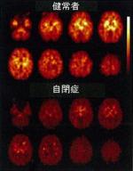 自閉症、脳内の神経の働きと関係－浜松医科大のサムネイル画像